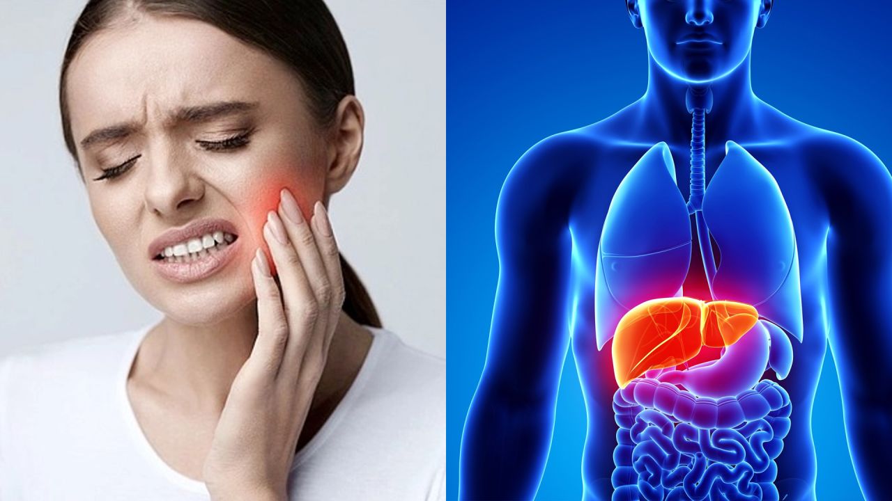 দাঁত-মাড়ির রোগ বাড়াচ্ছে লিভারের ঝুঁকি!