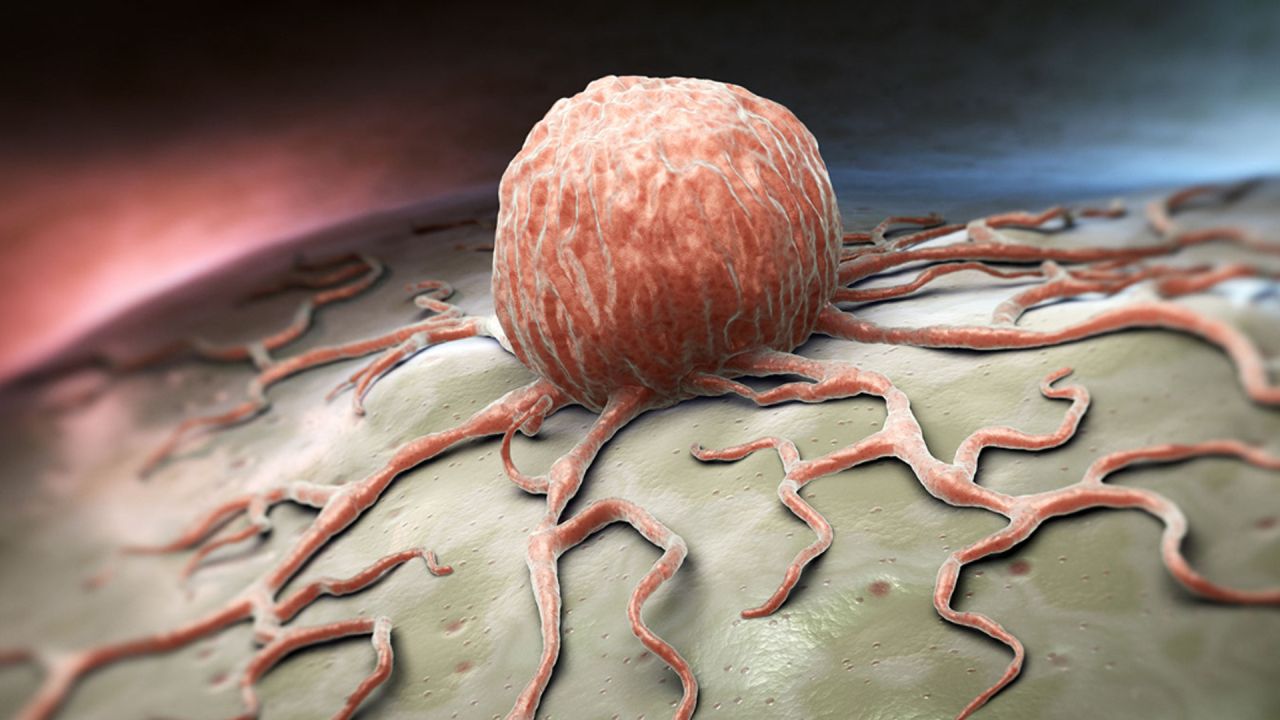 ক্যানসারের ঝুঁকি কমাতে পারে ৬ খাবার