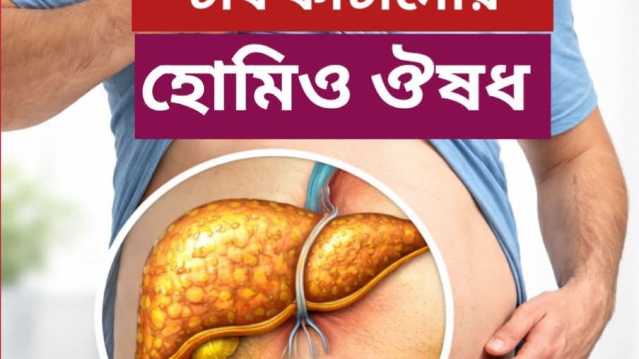 Fatty liver★এর হোমিওপ্যাথিক ঔষধ