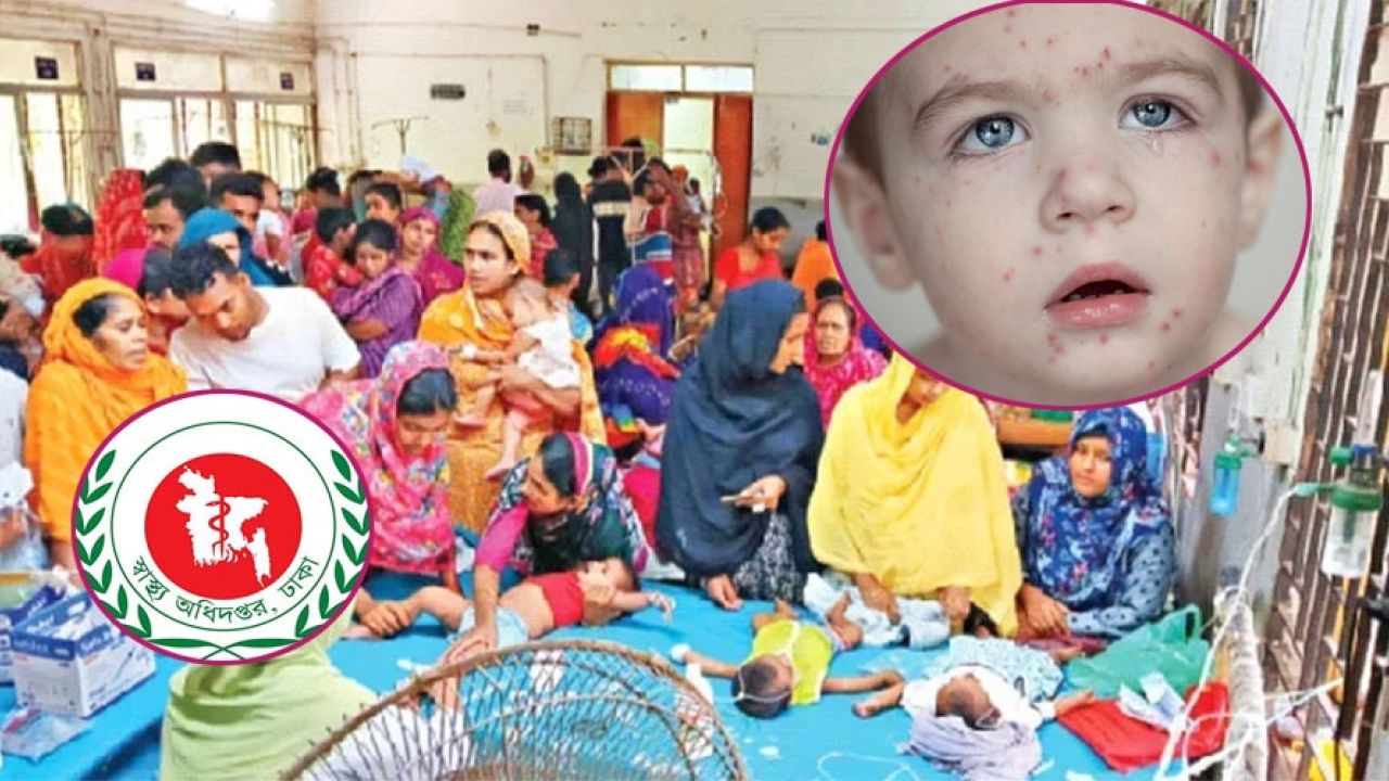 হামের প্রভাবে মৃত্যুর মিছিল যেন থামছেই না!